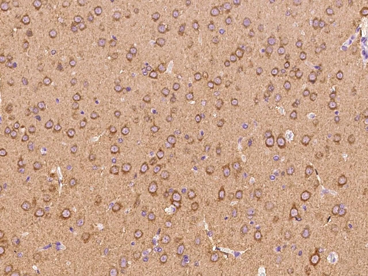 Syndapin I / PACSIN1 Antibody