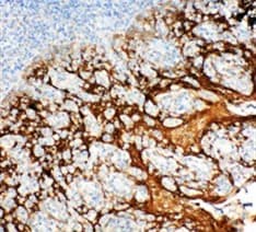 SFN / Stratifin / 14-3-3 Sigma Antibody (aa140-156)