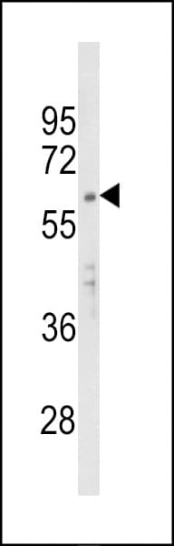 Polyclonal Rabbit anti-Human APEX2 Antibody (aa143-171, IHC, IF, WB)