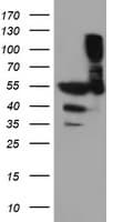 TUBAL3 Antibody (clone OTI5E4)