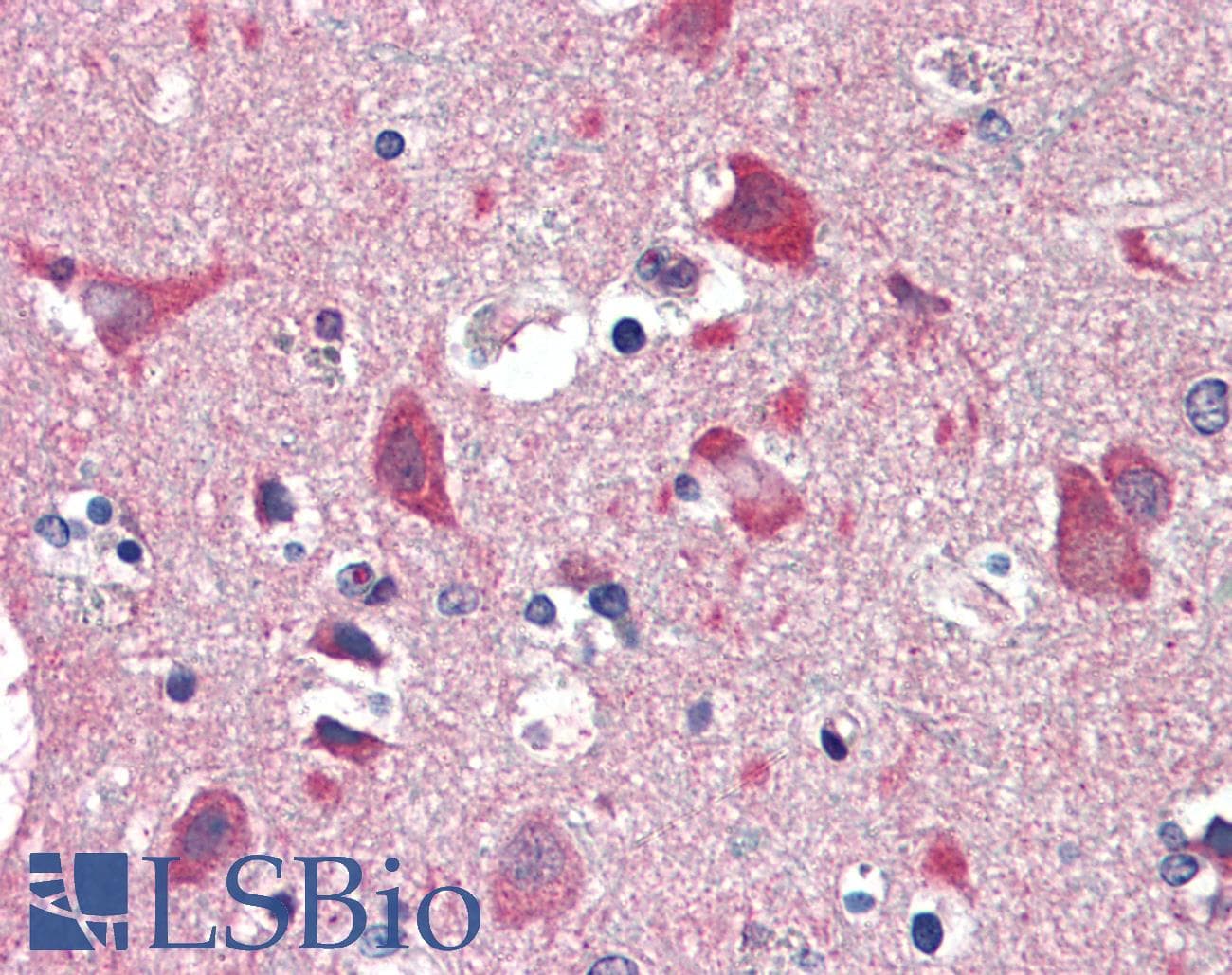 IHC-plus™ Polyclonal Rabbit anti-Human GUCY1B3 Antibody (aa189-207, IHC)