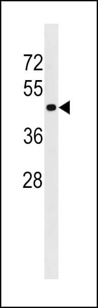Polyclonal Rabbit anti-Human TGFBR1 / ALK5 Antibody (aa145-172, WB)