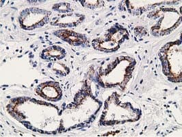 Monoclonal Mouse anti-Human SSX1 Antibody (clone OTI2F8, IHC, IF, WB)