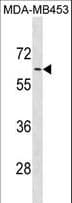 ADRA1B / Adrenoceptor alpha 1B Antibody (aa380-409)