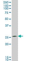 Monoclonal Mouse anti-Human THTPA Antibody (clone 3F6, WB)