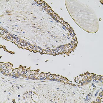 Polyclonal Rabbit anti-Human ABCC3 / MRP3 Antibody (IHC, WB)