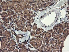 Monoclonal Mouse anti-Human MAP2K1 / MKK1 / MEK1 Antibody (clone OTI1A9, IHC, IF, WB)