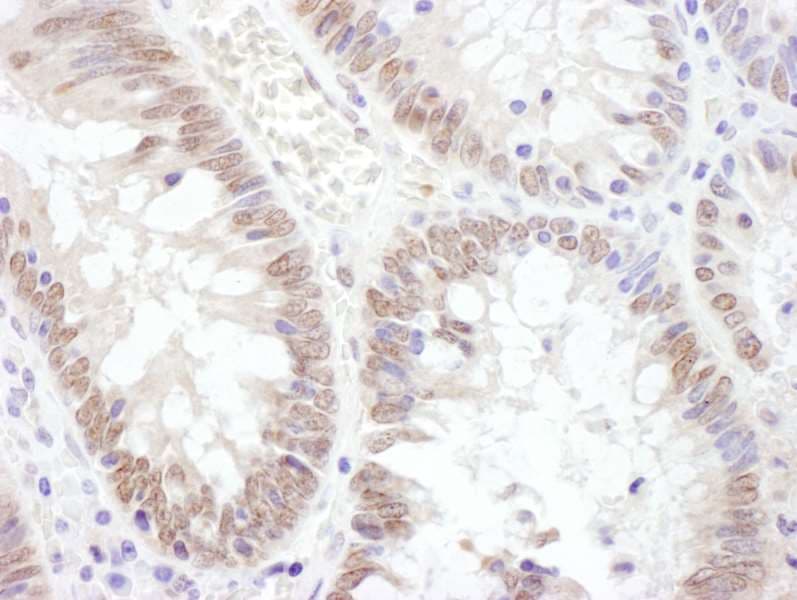 Polyclonal Rabbit anti-Human TAF1 Antibody (aa1750-1800, IHC, WB)