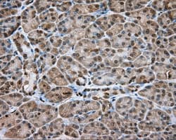 Monoclonal Mouse anti-Human NME4 Antibody (clone OTI1H1, IHC, IF, WB)