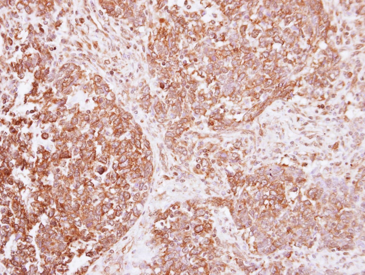 Polyclonal Rabbit anti-Human INSR / Insulin Receptor Antibody (IHC, WB)