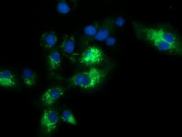 SQSTM1 Antibody (clone OTI4C8)