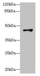 DCC1 / DSCC1 Antibody