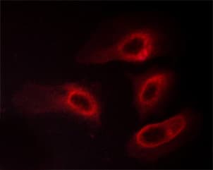 YWHAZ / 14-3-3 Zeta Antibody (phospho-Ser58)