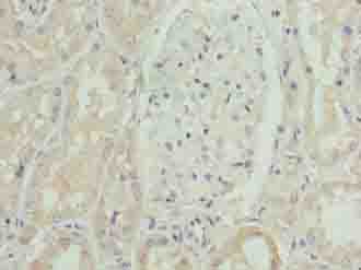 Polyclonal Rabbit anti-Human SLC46A3 Antibody (IHC, WB)
