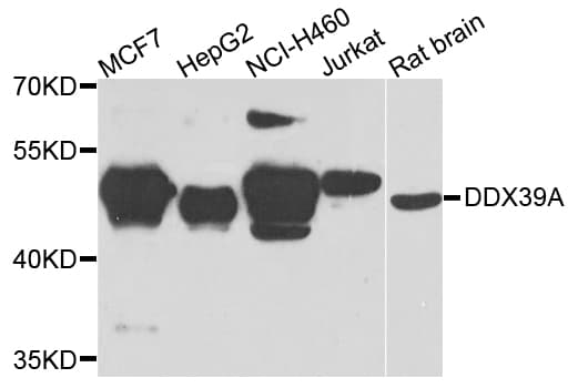 Polyclonal Rabbit anti-Human DDX39 Antibody (IHC, WB)