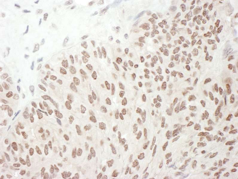 RELA / NFKB p65 Antibody (phospho-Ser468)