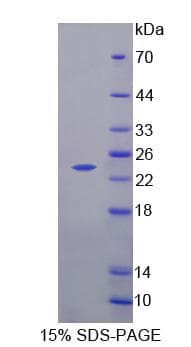 Human NCALD / Neurocalcin Delta Protein (Recombinant His, N-Terminal)