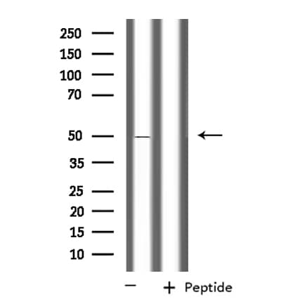 Polyclonal Rabbit anti-Human PPM1L Antibody (IF, WB)