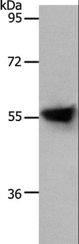 Polyclonal Rabbit anti-Human SLC1A4 / ASCT1 Antibody (IHC, WB)