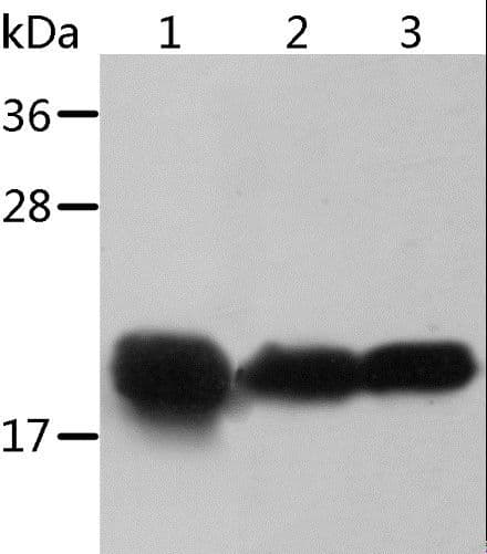 CRYAB / Alpha B Crystallin Antibody
