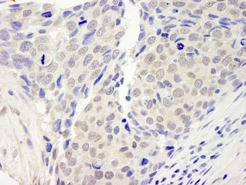 Polyclonal Rabbit anti-Human ZNF592 Antibody (aa950-1000, IHC)
