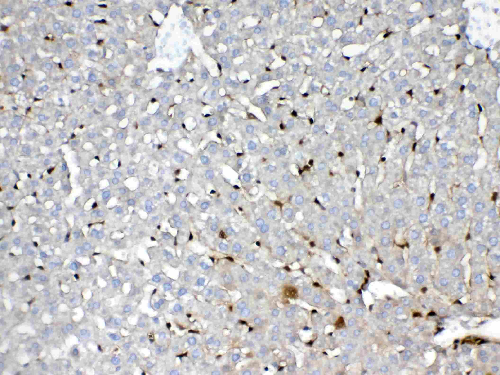 Polyclonal Rabbit anti-Mouse GSTP1 / GST Pi Antibody (IHC, WB)