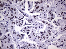 NBN / Nibrin Antibody (clone OTI6D10)