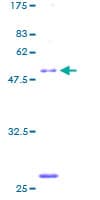Human ULBP2 / RAET1H Protein (Recombinant GST)