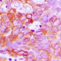 EFNA1 / Ephrin A1 Antibody (Internal)