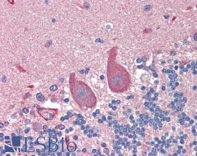 AGRN / Agrin Antibody (aa1856-2045)