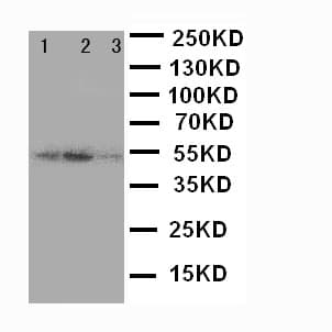 SERPINA4 / Kallistatin Antibody (aa384-401)