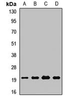 Polyclonal Rabbit anti-Human PDF / PLAB Antibody (WB)