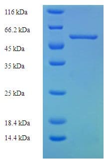 Human FAM49B / L1 Protein (Recombinant His-SUMO)