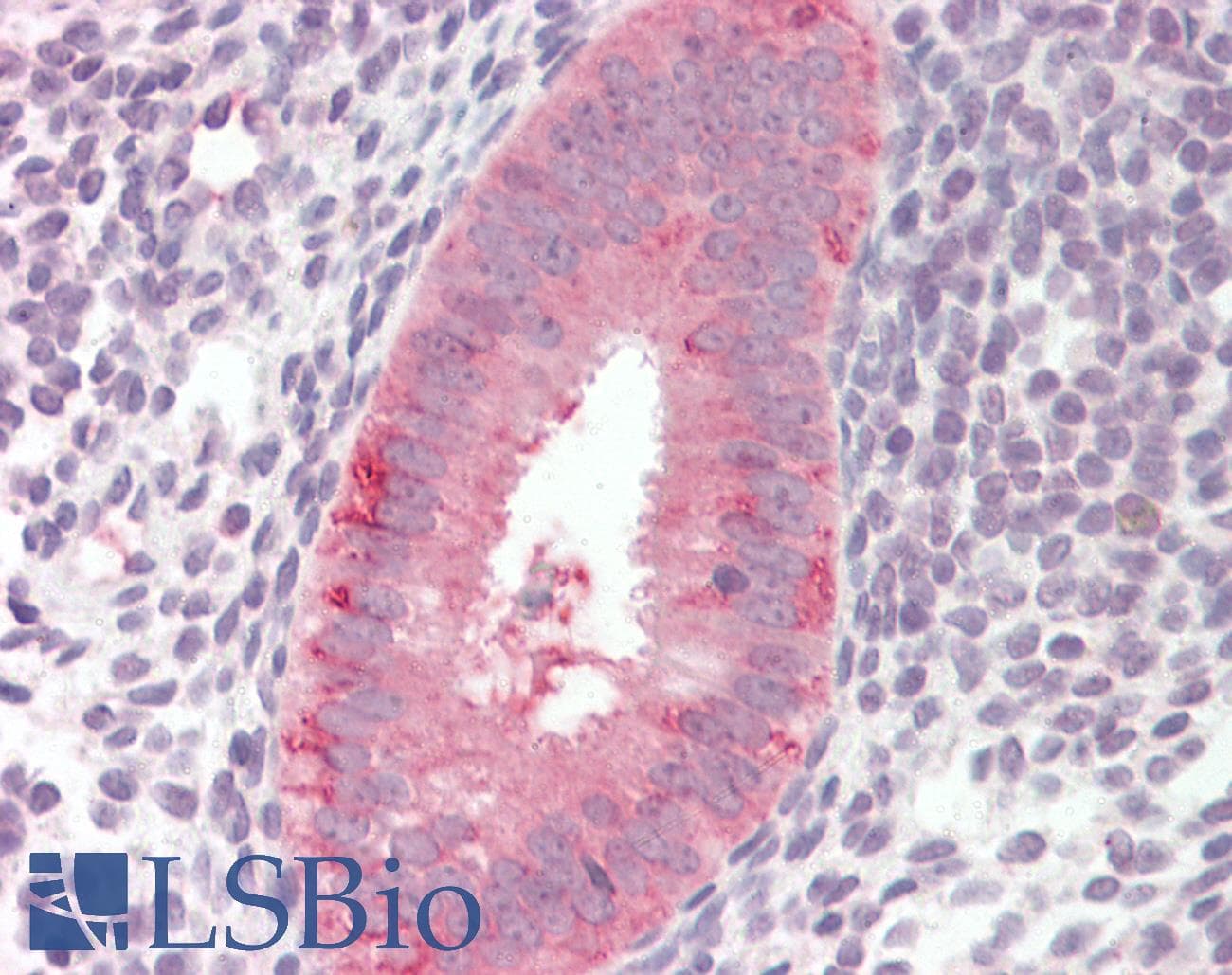 IHC-plus™ HK2 / Hexokinase 2 Antibody (clone 3D3)