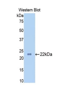 SLIT1 Antibody (aa611-791)