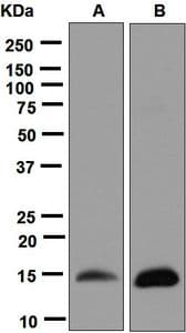 IHC-plus™ Monoclonal Rabbit anti-Human FABP3 / H-FABP Antibody (clone EPR6127, Internal, IHC, WB)