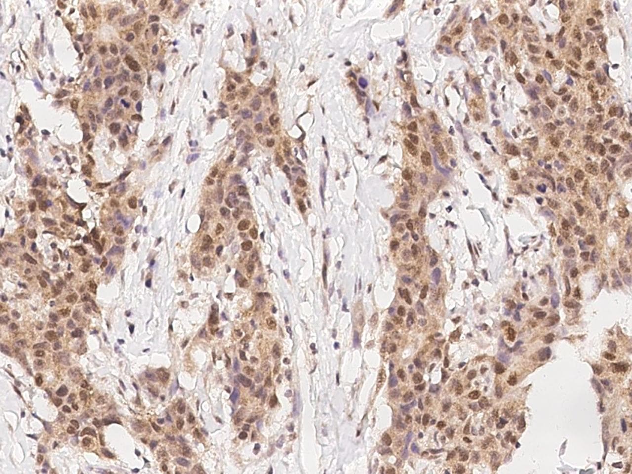 ADRA1B / Adrenoceptor alpha 1B Antibody