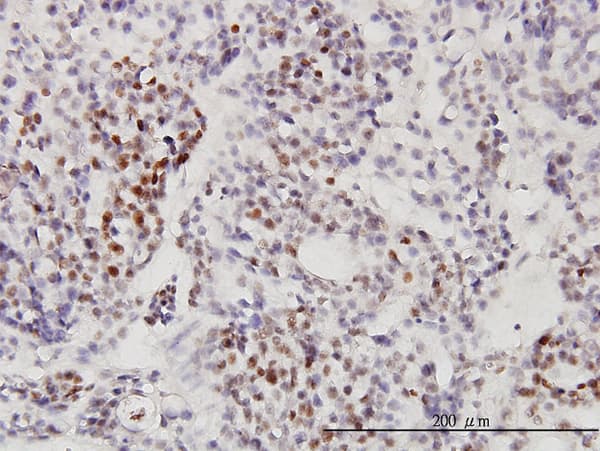 RRP9 Antibody (clone 1E8)