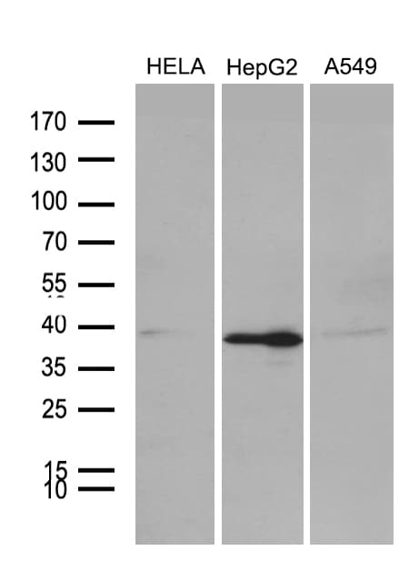 PHF20L1 Antibody (clone OTI1F4)
