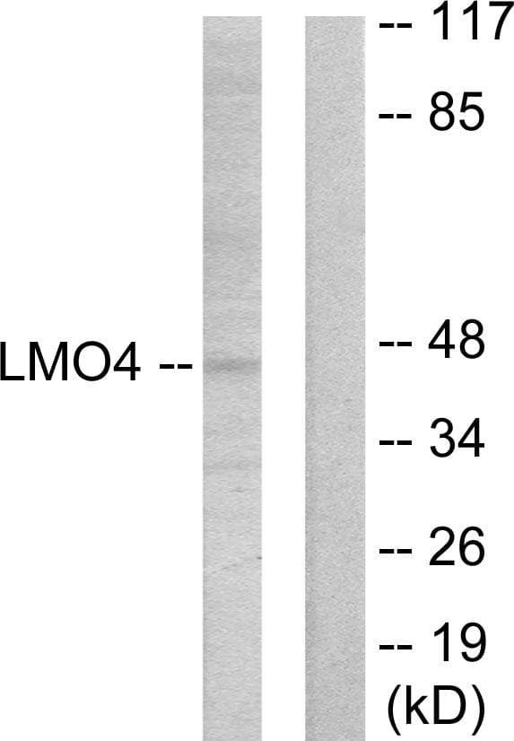 LMO4 Antibody