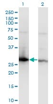 YWHAZ / 14-3-3 Zeta Antibody (clone 1B3)