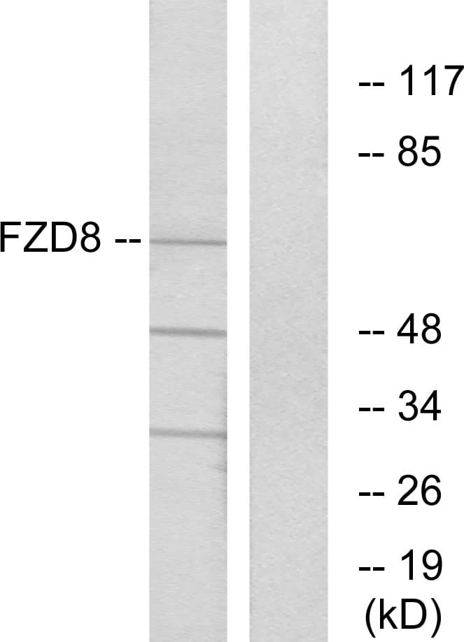 Polyclonal Rabbit anti-Human FZD8 / Frizzled 8 Antibody (aa486-535, WB)