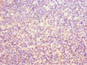 Polyclonal Rabbit anti-Human ORC6 / ORC6L Antibody (aa1-252, IHC, WB)