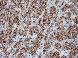 CTNNB1 / Beta Catenin Antibody (clone OTI1B11)