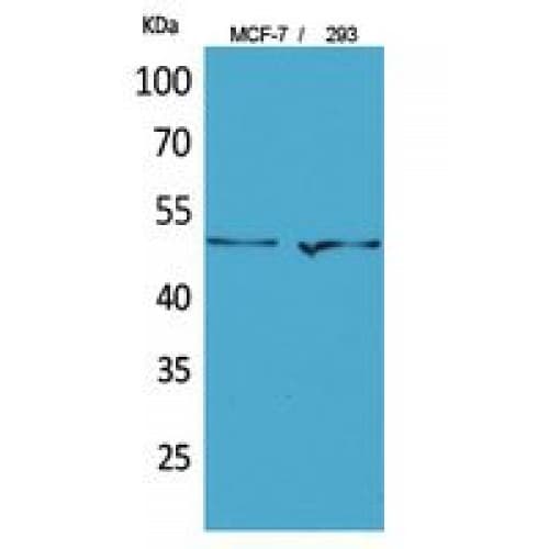 TP / Thymidine Phosphorylase Antibody (1-50 aa, N-terminal)