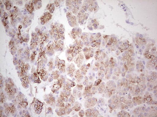 ABCB1 / MDR1 / P Glycoprotein Antibody (aa995-1280, clone OTI11D2, Carrier-free)