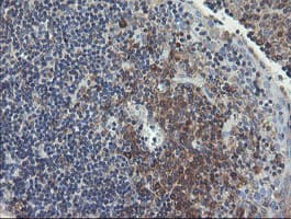 UBE2J1 Antibody (clone OTI3D1)