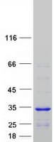 Human CCDC103 Protein (Recombinant Myc-DDK (Flag))