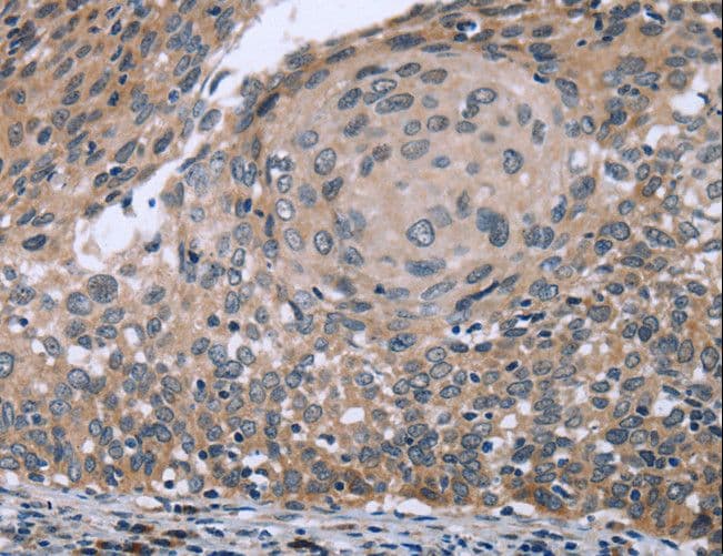 Polyclonal Rabbit anti-Human RNF144B Antibody (IHC, WB)