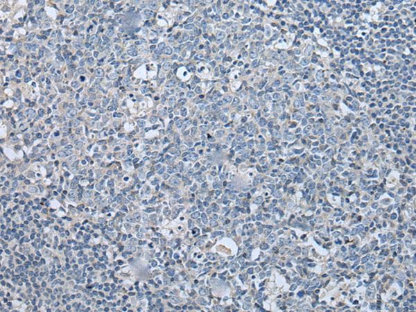 LASP1 Antibody